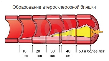 морфологический разбор слова атеросклероз