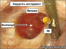 морфологический разбор слова фолликул