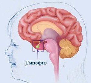 морфологический разбор слова гипофиз