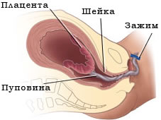 морфологический разбор слова послед